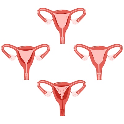 Beckenboden Belastung durch Schwangerschaft und Geburt - Rückbildung durch Online Yoga